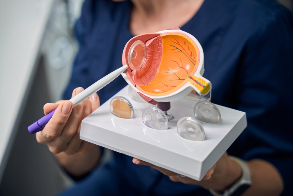 Close-up of doctor holding an eye model thumbnail