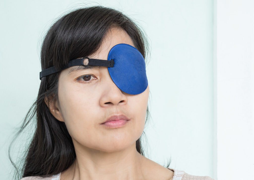 Woman Eye patch Pterygium Surgery Eye Medical Health Protection thumbnail